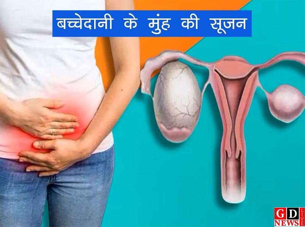 पाकुड़ और साहिबगंज में 4-5 जनवरी को आयोजित होगा मेगा महिला स्वास्थ्य एवं दृष्टि सुरक्षा शिविर 7 img 20250102 wa00162237978878727300520