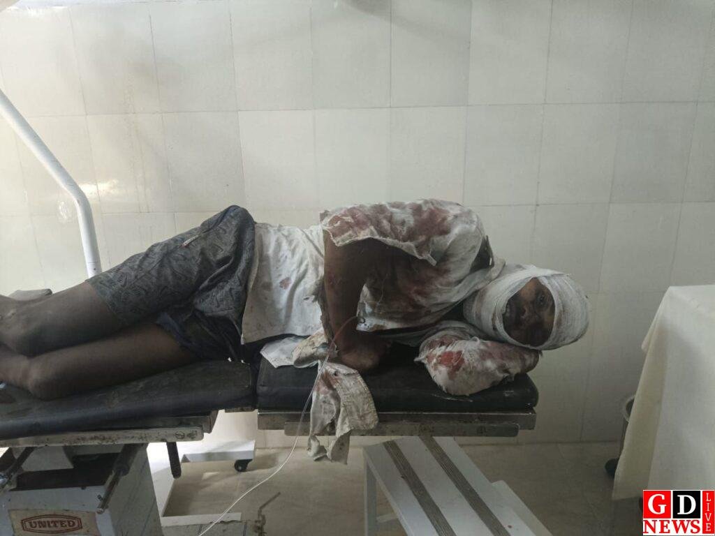 हाइवा और मोटरसाइकिल की टक्कर, एक व्यक्ति गंभीर रूप से घायल। 7 img 20250301 wa00331178156469696999082