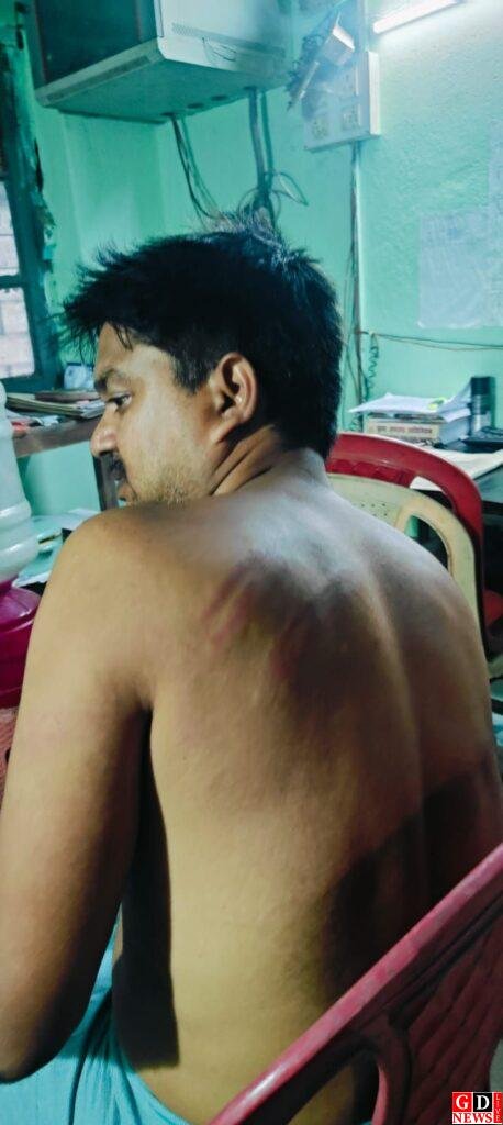 बंधक बनाए गए ट्रेक्टर चालक को छुड़ाने गए पुलिस दल पर लोगो ने हथियारों से किया हमला 13 img 20251019 wa00102685699638131641692