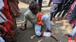 बाइक और टोटो की जोरदार टक्कर, युवक की टांग टूटी, सिर पर गंभीर चोट। 10 IMG 20251107 WA0024