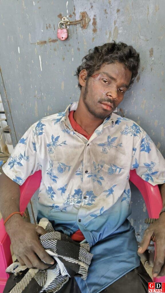 तेज रफ्तार बनी हादसे की वजह, बाइक गिरने से दो किशोर गंभीर रूप से घायल 8 img 20260110 wa00289057668064885453480