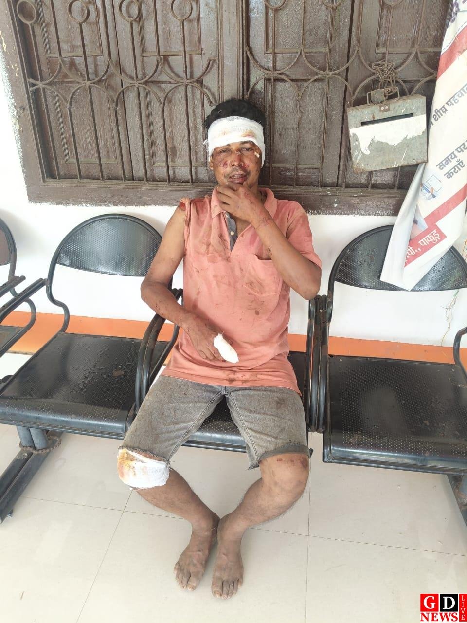 अज्ञात वाहन की टक्कर से बाइक सवार घायल, हादसे के बाद चालक वाहन लेकर फरार।
